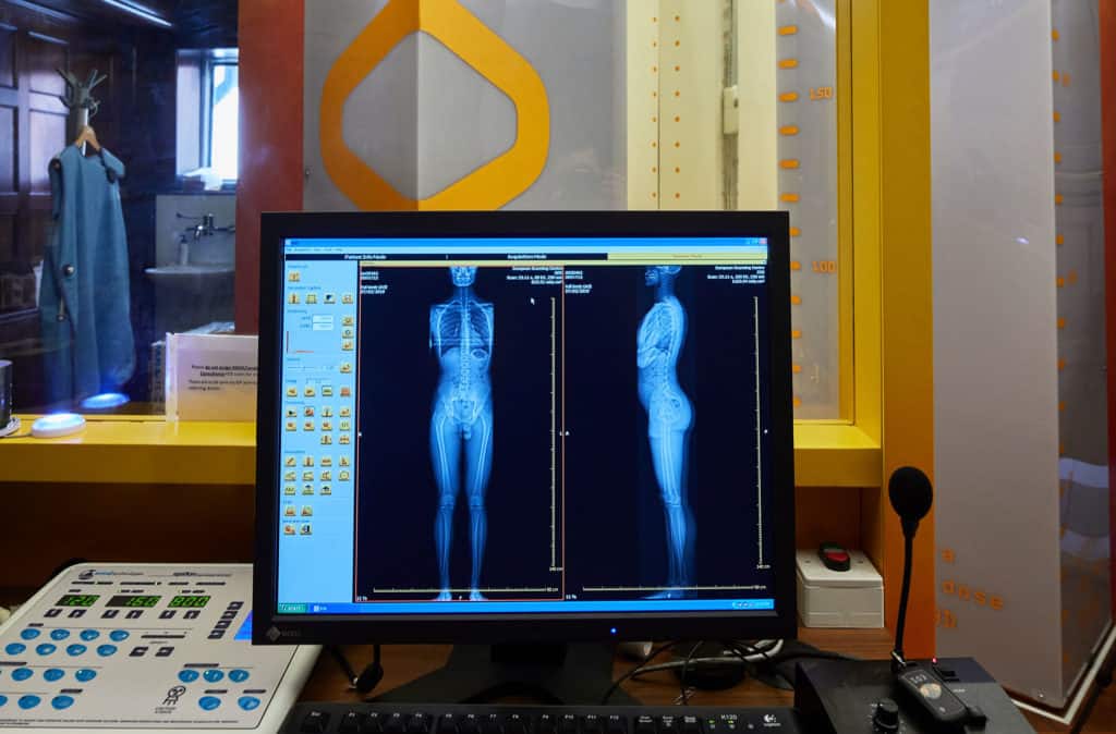 Advanced Body Scan offers technology to detect a disease before symptoms  appear