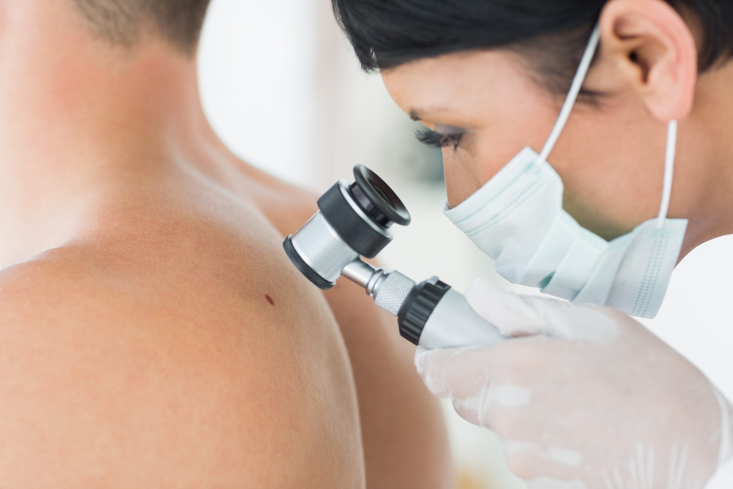 Sun Exposure & Skin Cancer: Why Mole Screening Is Vital